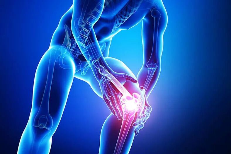 síntomas de la osteoartritis